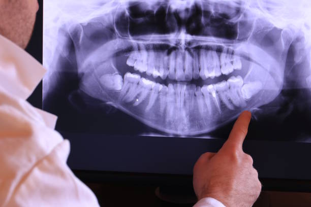Best Emergency Treatment for Toothache in Lakeview, CA