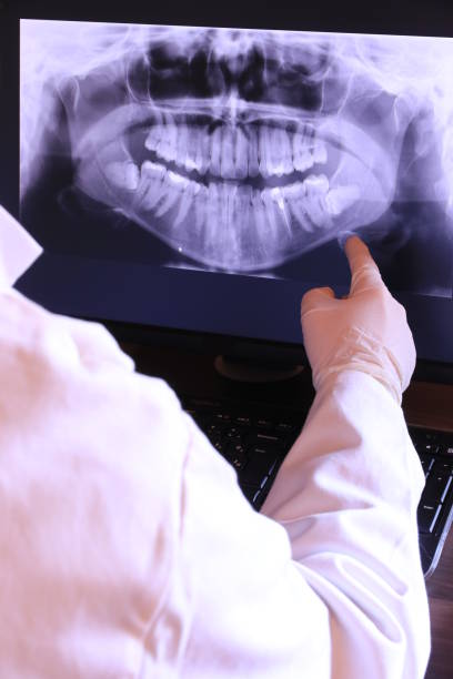 Best Emergency Tooth Extraction in Lakeview, CA