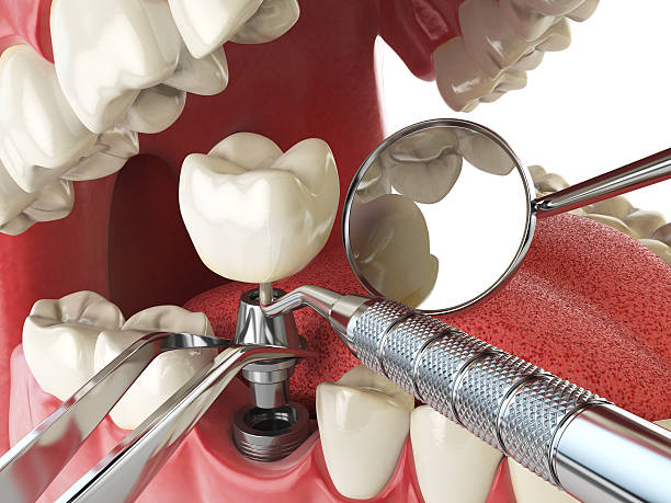 Best After-Hours Emergency Dentist in Lakeview, CA